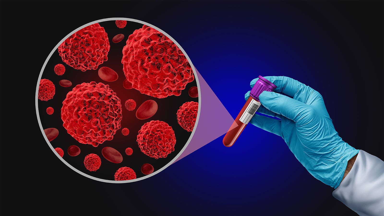 Liquid Biopsy for CRC Screening May Not Be Ready for Prime Time